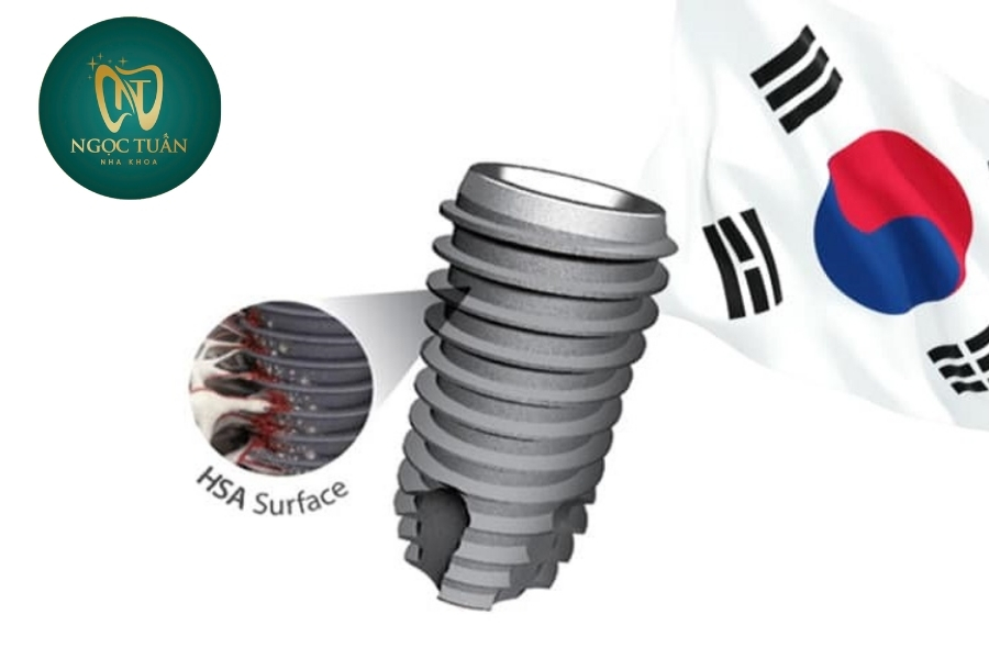 Trồng Răng Trụ Implant Hàn Quốc